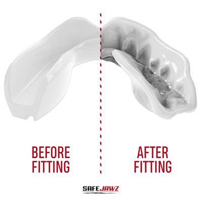 SafeJawz Intro Series Mouthguard White