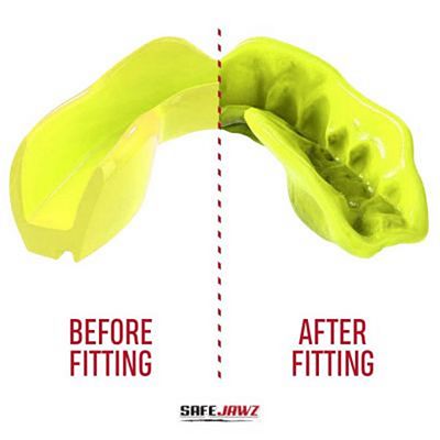 SafeJawz Intro Series Mouthguard Yellow