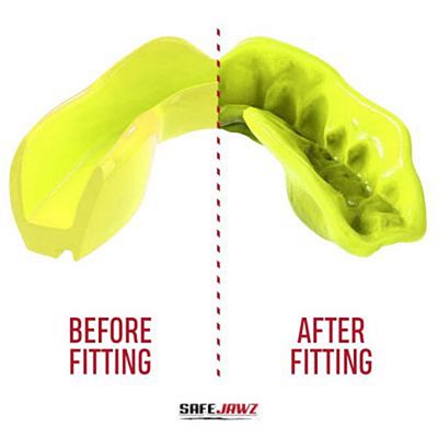 SafeJawz Intro Series Mouthguard Jaune